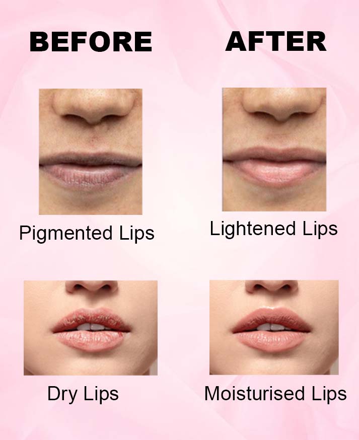 LIP LIGHTENER BALM