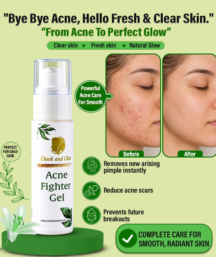 Acne Fighter Gel