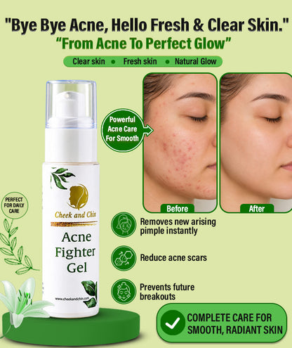 Acne Fighter Gel