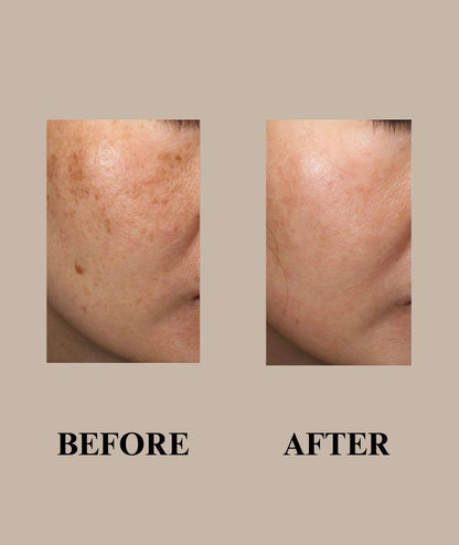 Super Glow Urgent Facial