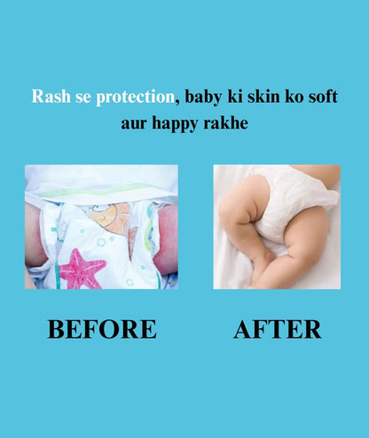 Baby Nappy Rash Cream