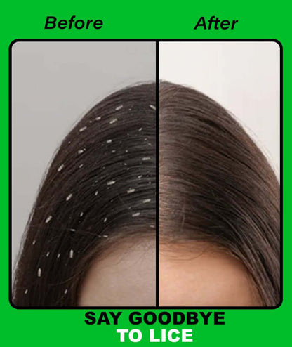 Anti Lice oil